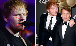 Ed Sheeran vekket oppsikt med kongelig sverdulykke. Nå avslører kompisen sannheten