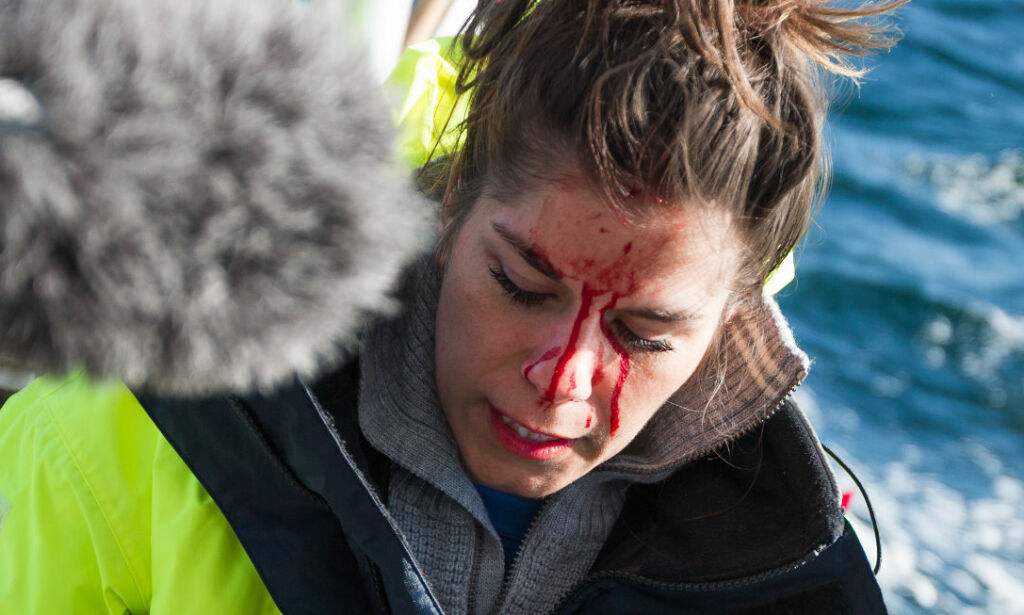 Bloggeren havnet i blodig drama under tv-innspilling: - Fikk sjokk