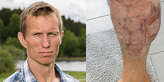 Birkebeinerrennet endte i smertehelvete for «Farmen»-Frank