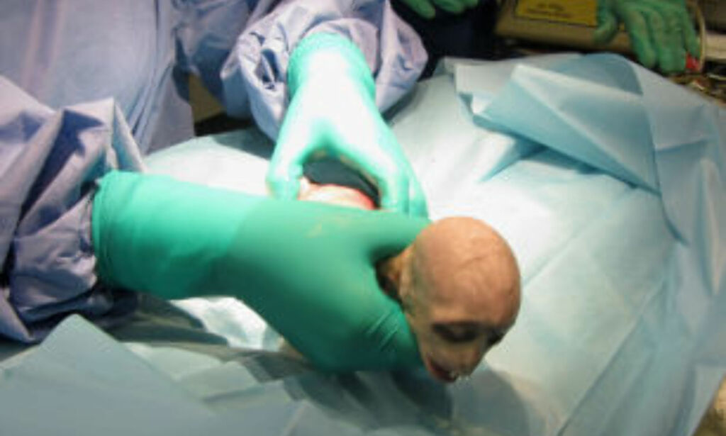 Apebabyen som fikk dyrehagen til å sperre opp øynene. Er klin lik Voldemort